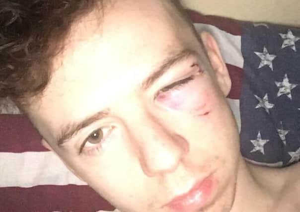 Conol Cassidy was struck twice on the face during the attack.