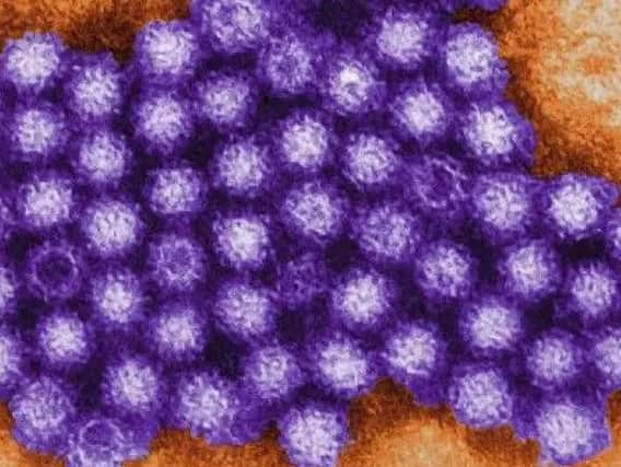 The norovirus