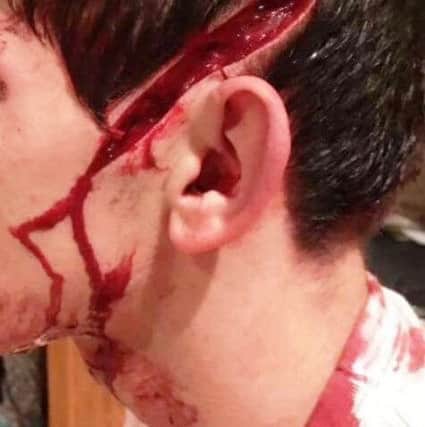 Horrific injury sustained by man allegedly attacked with a sword at a house on the outskirts of Buncrana over the Christmas period.