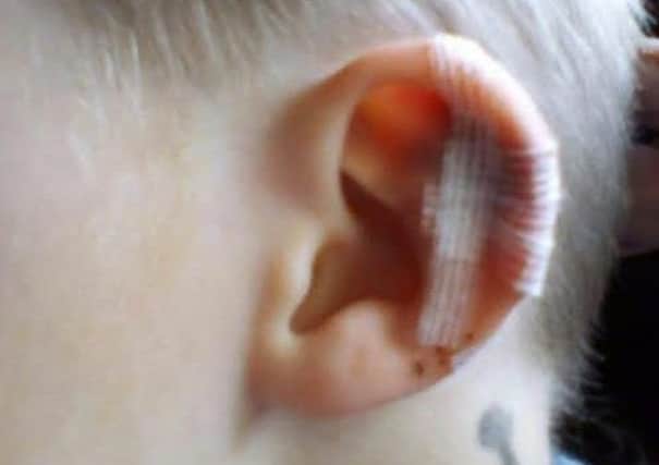 The injuries inflicted on three-year-old Riley after he was attacked by a dog in Creggan.