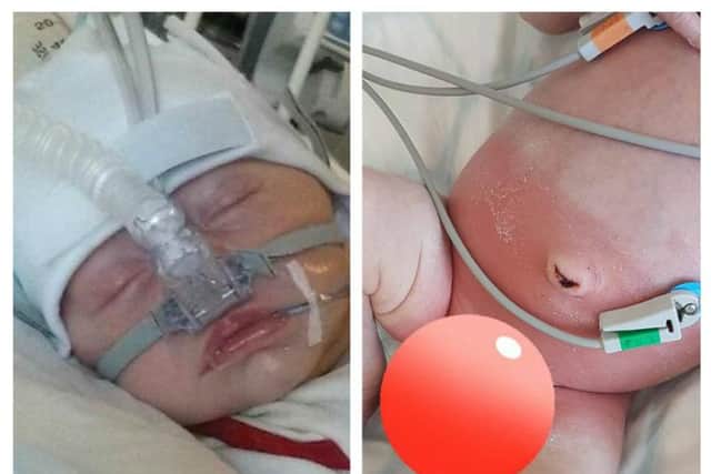 Mr. Bartliff claims ASDA own brand nappies caused his newborn son to require oxygen and irritated his skin. (Photos: Jordan Bartliff/Facebook)